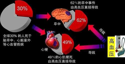 没症状不代表没伤害，高血压对身体的危害你知道多少？