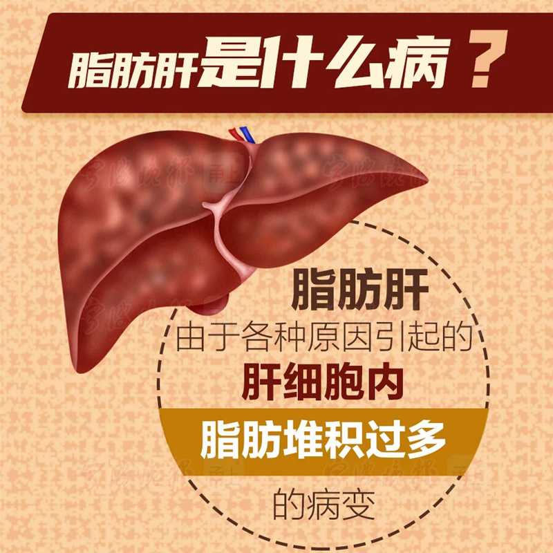 哪些药物可以治疗脂肪肝？