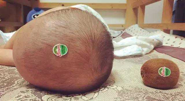 宝宝头发黄是缺营养吗？