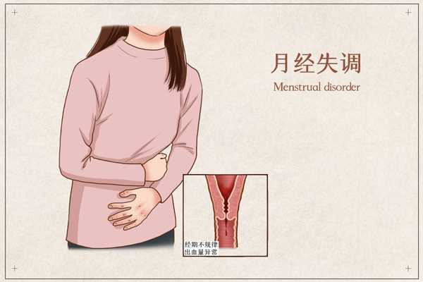 什么是月经失调