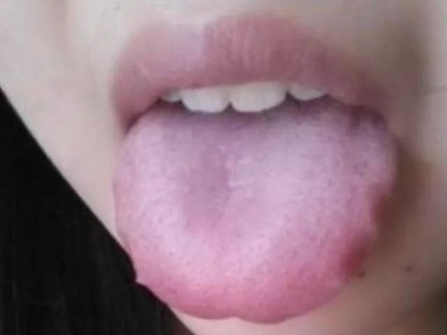 脾胃虚弱害处大，脾虚不虚看嘴就知道！