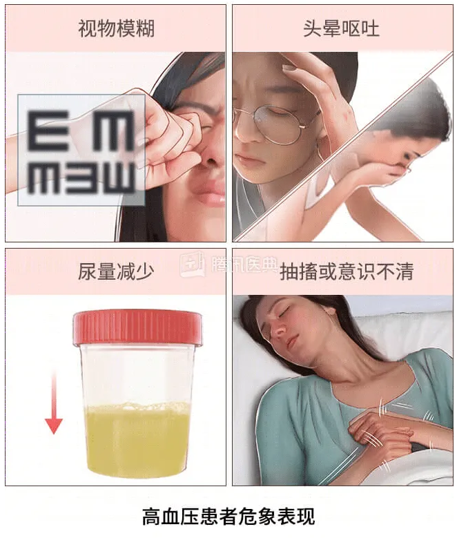 高血压患者危象表现