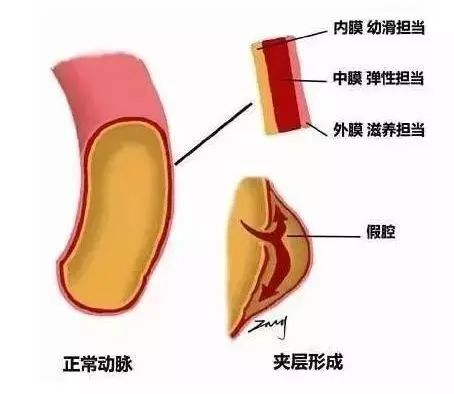 男人肾不行，更容易得高血压！关注肾血管性高血压症