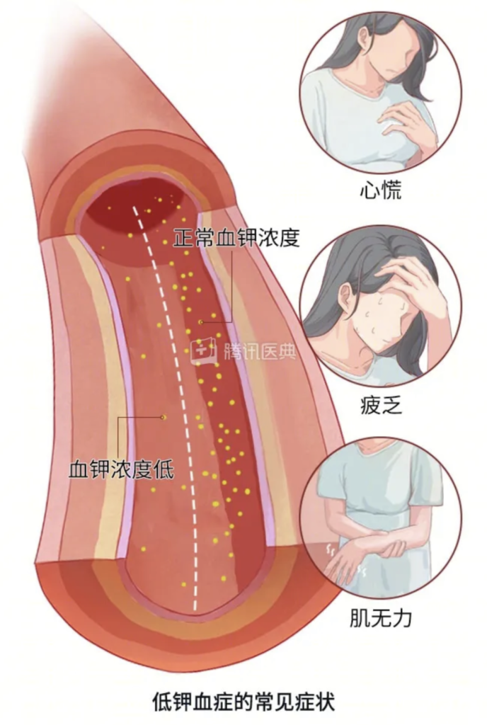 男人肾不行，更容易得高血压！关注肾血管性高血压症