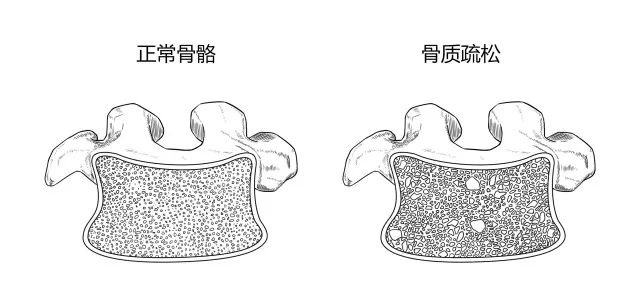 10种常见疾病的症状及危害！