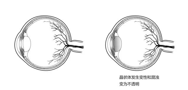 10种常见疾病的症状及危害！