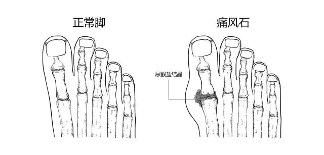 10种常见疾病的症状及危害！