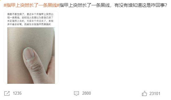 指甲长黑线、杵状指、手指结节肿块，三种手指的特异变化，要警惕是癌症信号！