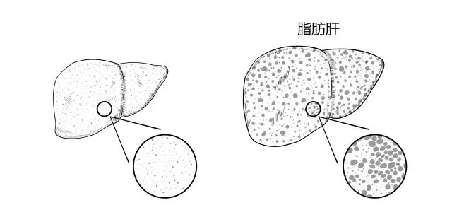 10种常见疾病的症状及危害！
