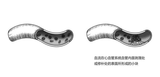 10种常见疾病的症状及危害！
